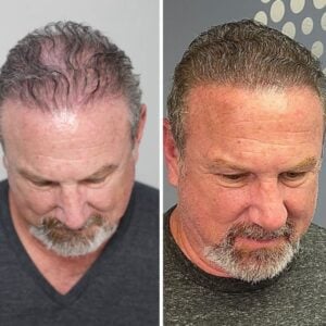 Men’s Density Fill